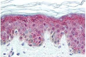 Human Skin (formalin-fixed, paraffin-embedded) stained with DNMT1 antibody ABIN305735 at 5 ug/ml followed by biotinylated anti-mouse IgG secondary antibody ABIN481714, alkaline phosphatase-streptavidin and chromogen. (DNMT1 antibody  (AA 637-650))