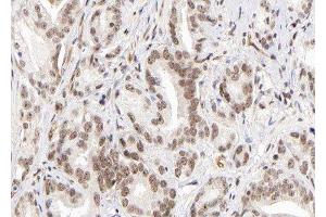 Lysine (K)-Specific Methyltransferase 2B (KMT2B) (Internal Region) antibody