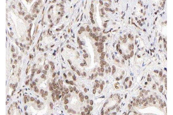 Lysine (K)-Specific Methyltransferase 2B (KMT2B) (Internal Region) antibody