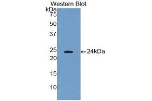 Western Blotting (WB) image for anti-Phospholipase A2, Group IVA (Cytosolic, Calcium-Dependent) (PLA2G4A) (AA 563-749) antibody (ABIN1174847) (PLA2G4A antibody  (AA 563-749))
