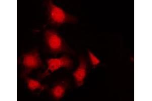 Immunofluorescence (fixed cells) (IF/ICC) image for anti-Janus Kinase 2 (JAK2) (pTyr570) antibody (ABIN6256765)