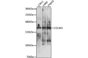 Western blot analysis of extracts of various cell lines, using COL4 antibody (ABIN6130196, ABIN6138845, ABIN6138846 and ABIN6225111) at 1:1000 dilution. (COL4a5 antibody  (AA 1462-1691))