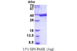 SDS-PAGE (SDS) image for Aldo-Keto Reductase Family 1, Member B1 (Aldose Reductase) (AKR1B1) (AA 1-316) (Active) protein (His tag) (ABIN5854099)
