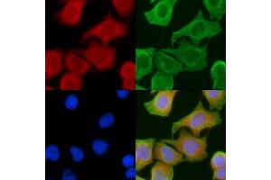 ABIN6258514 and ABIN6274732 staining Hela cells(45 min of heat-shock) by IF/ICC. (MRPL16 antibody  (Internal Region))
