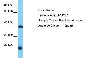Host: Rabbit Target Name: SPDYE1 Sample Type: Fetal Heart lysates Antibody Dilution: 1. (SPDYE1 antibody  (N-Term))