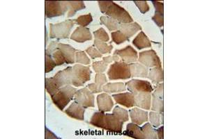 CFB Antibody immunohistochemistry analysis in formalin fixed and paraffin embedded human skeletal muscle followed by peroxidase conjugation of the secondary antibody and DAB staining. (Complement Factor B antibody  (AA 469-494))
