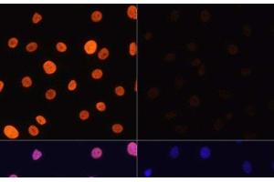 Immunofluorescence analysis of C6 cells using Acetyl-Histone H3-K4 Polyclonal Antibody at dilution of 1:100. (Histone 3 antibody  (acLys4))