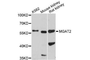 Western blot analysis of extracts of various cell lines, using MGAT2 antibody (ABIN5996502) at 1/1000 dilution. (MGAT2 antibody)