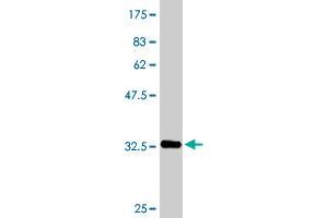 Western Blot detection against Immunogen (33. (SFRS6 antibody  (AA 1-75))