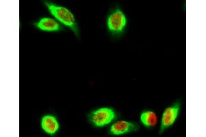 Immunofluorescence analysis of Hela cell. (Ki-67 antibody)