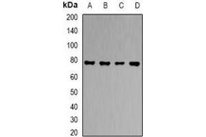 Western blot analysis of RBAT expression in HT29 (A), HepG2 (B), PC12 (C), mouse liver (D) whole cell lysates. (SLC3A1 antibody)