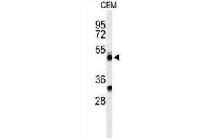 Western Blotting (WB) image for anti-Complement Factor P (CFP) antibody (ABIN3004386) (CFP antibody)