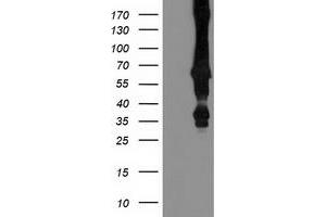 Western Blotting (WB) image for anti-Mahogunin, Ring Finger 1 (MGRN1) antibody (ABIN1499460) (Mahogunin RING Finger Protein 1 antibody)