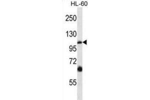 Western Blotting (WB) image for anti-Transient Receptor Potential Cation Channel, Subfamily C, Member 5 (TRPC5) antibody (ABIN2997528) (TRPC5 antibody)