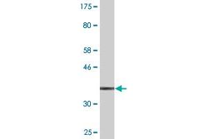 Western Blot detection against Immunogen (38. (S100A9 antibody  (AA 1-114))