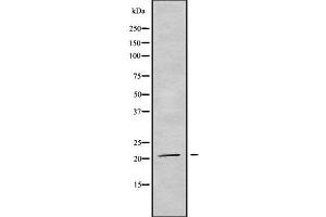 Western blot analysis of TRAPPC5 using HuvEc whole cell lysates (TRAPPC5 antibody  (Internal Region))