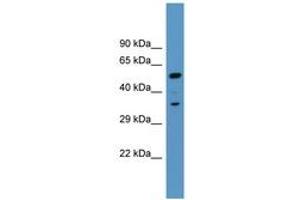 Image no. 1 for anti-Myristoylated Alanine-Rich Protein Kinase C Substrate (MARCKS) (AA 256-305) antibody (ABIN6746804) (MARCKS antibody  (AA 256-305))
