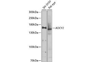 Western blot analysis of extracts of various cell lines, using  antibody (ABIN6129185, ABIN6136559, ABIN6136560 and ABIN6225105) at 1:1000 dilution. (ADCY2 antibody  (AA 430-600))