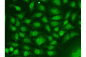 Immunofluorescence analysis of A549 cells using RAD17 antibody. (RAD17 antibody  (AA 391-670))