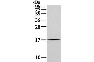 Gel: 12 % SDS-PAGE, Lysate: 40 μg, Lane: Human normal kidney tissue, Primary antibody: ABIN7193094(ZFAND2A Antibody) at dilution 1/300 dilution, Secondary antibody: Goat anti rabbit IgG at 1/8000 dilution, Exposure time: 2 minutes (ZFAND2A antibody)