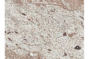 Immunohistochemistry analysis using Rabbit Anti-LRP1 Polyclonal Antibody (ABIN5696032). (LRP1 antibody  (AA 160-260) (APC))