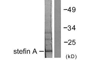 Western Blotting (WB) image for anti-Cystatin A (Stefin A) (CSTA) (Internal Region) antibody (ABIN1848778) (CSTA antibody  (Internal Region))