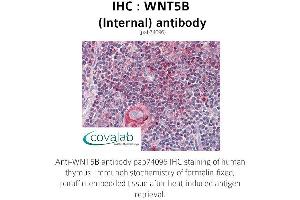 Image no. 1 for anti-Wingless-Type MMTV Integration Site Family, Member 5B (WNT5B) (Internal Region) antibody (ABIN1740832) (WNT5B antibody  (Internal Region))