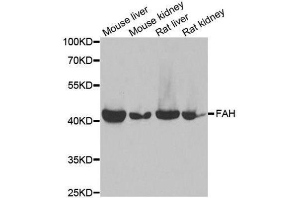 FAH antibody  (AA 1-419)