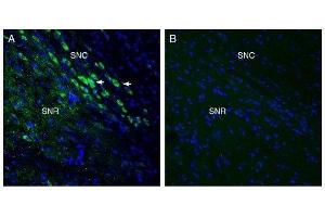 Expression of MCU in mouse midbrain. (MCU antibody  (Mitochondrial Matrix))