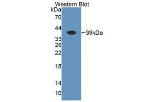 Western blot analysis of the recombinant protein. (CISH antibody  (AA 1-258))