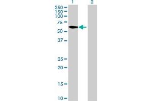 Western Blot analysis of C8orf45 expression in transfected 293T cell line by C8orf45 MaxPab polyclonal antibody. (C8orf45 antibody  (AA 1-585))