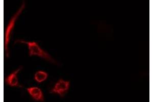 ABIN6275450 staining HeLa cells by IF/ICC. (RASA3 antibody  (Internal Region))