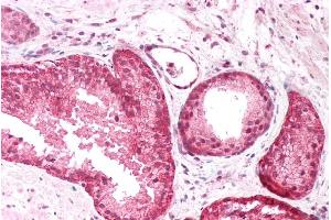 ABIN185725 (5µg/ml) staining of paraffin embedded Human Prostate. (PICK1 antibody  (Internal Region))