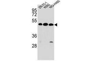 KREMEN2 Antibody (Center) western blot analysis in ZR-75-1,K562,NCI-H460 cell line lysates (35µg/lane). (KREMEN2 antibody  (Middle Region))