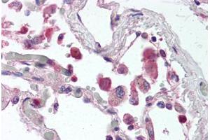 Human Lung (formalin-fixed, paraffin-embedded) stained with TLR9 antibody ABIN337069 at 5 ug/ml followed by biotinylated anti-mouse IgG secondary antibody ABIN481714, alkaline phosphatase-streptavidin and chromogen. (TLR9 antibody  (AA 268-284))