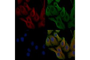 ABIN6257449 and ABIN6275470 staining Hela cells by IF/ICC.
