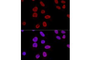 Confocal immunofluorescence analysis of U2OS cells using Ku70 Polyclonal Antibody (ABIN6134460, ABIN6150312, ABIN6150313 and ABIN6223171) at dilution of 1:100. (XRCC6 antibody  (AA 408-609))