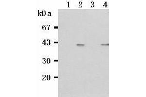 Western Blotting (WB) image for anti-Tumor Necrosis Factor Receptor Superfamily, Member 13C (TNFRSF13C) antibody (ABIN1449226) (TNFRSF13C antibody)