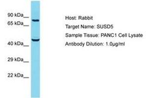 Image no. 1 for anti-Sushi Domain Containing 5 (SUSD5) (AA 304-353) antibody (ABIN6750594) (SUSD5 antibody  (AA 304-353))