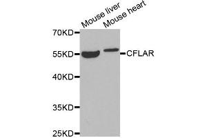 Western blot analysis of extracts of mouse liver and mouse heart tissues, using CFLAR antibody.