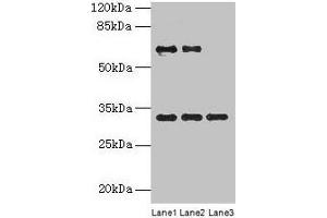 Western blot All lanes: OTX2 antibody at 4 μg/mL Lane 1: Jurkat whole cell lysate Lane 2: Hela whole cell lysate Lane 3: Mouse lung tissue Secondary Goat polyclonal to rabbit IgG at 1/10000 dilution Predicted band size: 32, 33 kDa Observed band size: 32 kDa (OTX2 antibody  (AA 1-297))