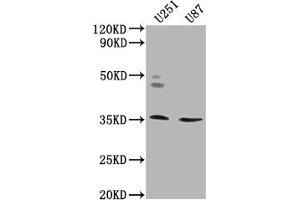 Western Blot Positive WB detected in: U251 whole cell lysate, U87 whole cell lysate All lanes: OR5K2 antibody at 1:2000 Secondary Goat polyclonal to rabbit IgG at 1/50000 dilution Predicted band size: 36 kDa Observed band size: 36 kDa (OR5K2 antibody  (AA 6-24))