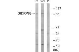 Western blot analysis of extracts from Jurkat cells and COS cells, using GIDRP88 antibody. (GIDRP88 antibody)