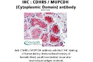 Image no. 2 for anti-Mucin and Cadherin-Like (CDHR5) (Cytoplasmic Domain) antibody (ABIN1732921) (CDHR5 antibody  (Cytoplasmic Domain))