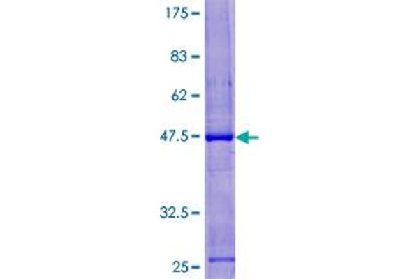 ZMYM6 Protein (AA 1-184) (GST tag)