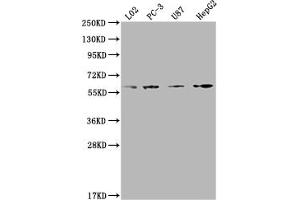 Western Blot Positive WB detected in: L02 whole cell lysate, PC-3 whole cell lysate, U87 whole cell lysate, HepG2 whole cell lysate All lanes: ICAM3 antibody at 1:2000 Secondary Goat polyclonal to rabbit IgG at 1/50000 dilution Predicted band size: 60 kDa Observed band size: 60 kDa (ICAM-3/CD50 antibody  (AA 200-547))