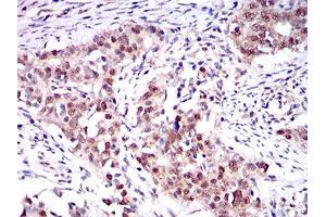 Immunohistochemistry (IHC) image for anti-One Cut Homeobox 3 (ONECUT3) (AA 350-455) antibody (ABIN1724872)