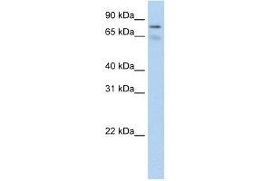 Western Blotting (WB) image for anti-Bromodomain Containing 4 (BRD4) (C-Term) antibody (ABIN2780921)