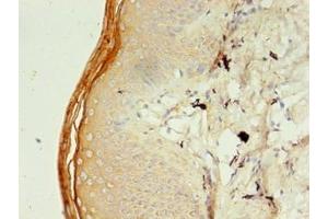 Immunohistochemistry of paraffin-embedded human skin tissue using ABIN7151288 at dilution of 1:100 (TRIM9 antibody  (AA 1-550))