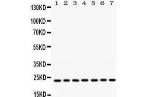 Western Blotting (WB) image for anti-V-Ral Simian Leukemia Viral Oncogene Homolog B (Ras Related, GTP Binding Protein) (Ralb) (AA 166-203), (C-Term) antibody (ABIN3043919)